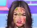 Žaidimas Princesės odos gydytojas internete Žaidimas Princesės odos gydytojas internete